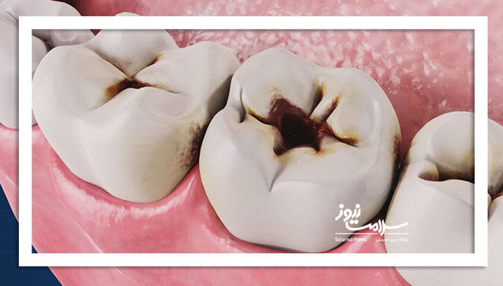 دمنوش‌هایی که دندان را پوسیده می‌کنند