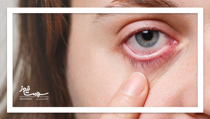هشدار خاموش چشم‌ها؛ وقتی بینایی ناگهان خاموش می‌شود