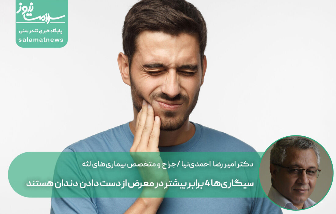 سیگاری‌ها ۴ برابر بیشتر در معرض از دست دادن دندان هستند