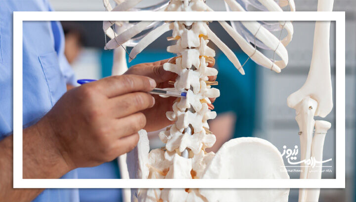 پوکی استخوان؛ بیماری خاموش با پیامدهای خطرناک برای سالمندان