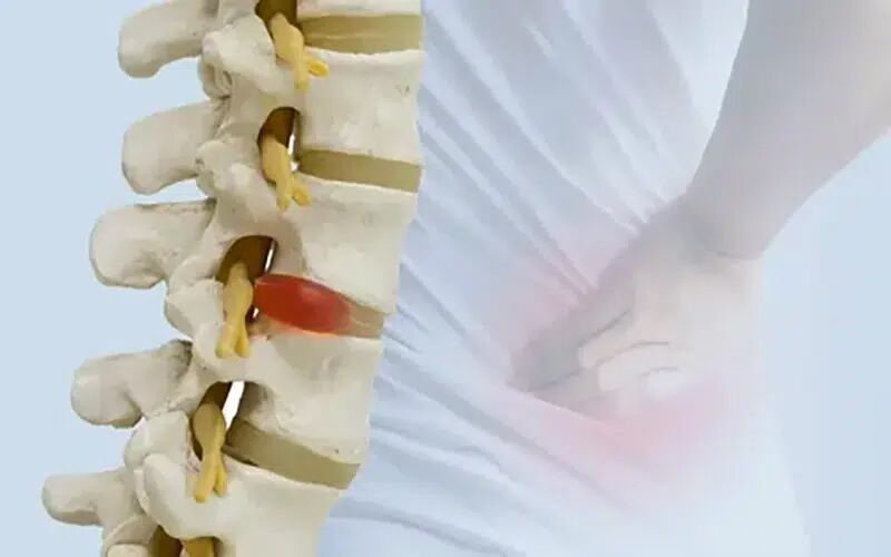 کلینیک فوق تخصصی دیسک کمر و گردن