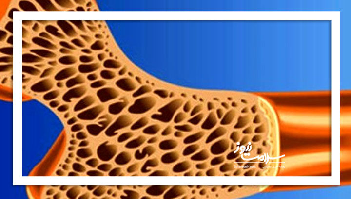 استخوان‌های شکننده گاهی مرگ می‌آفرینند