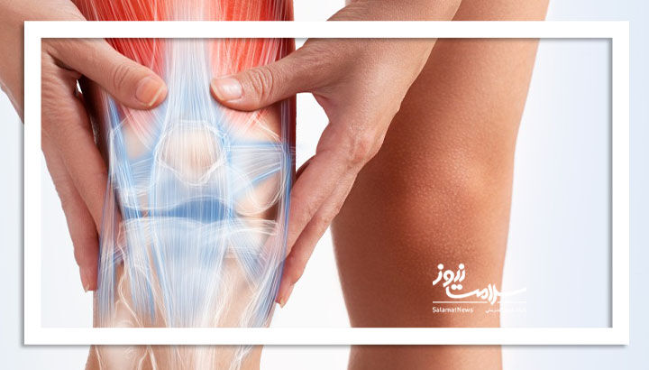 بهترین‌ تمرینات برای رفع آرتروز زانو