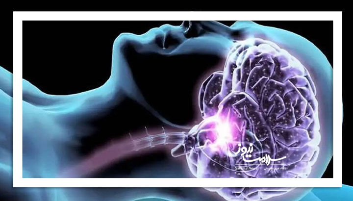 بیماری لثه؛ عامل خطر آسیب مغزی و زوال عقل