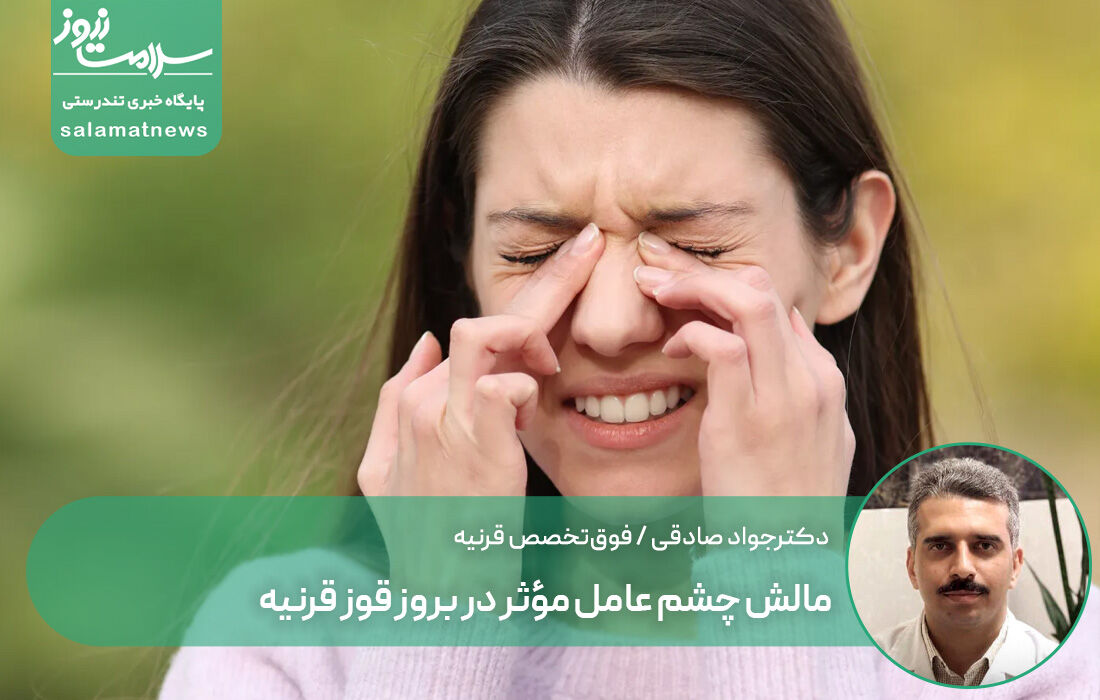 مالش چشم عامل مؤثر در بروز قوز قرنیه؛ هشدار برای افراد با سابقه آلرژی چشمی