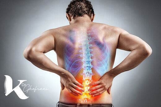 بیرون زدگی دیسک کمر