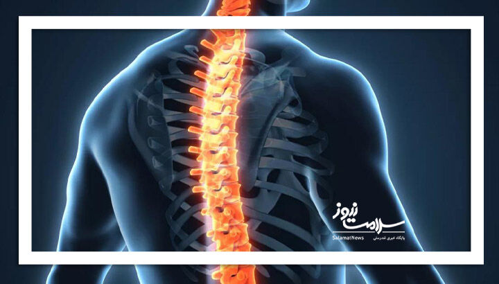 افزایش مشکلات ستون فقرات در نسل جوان: خطرات و روش‌های درمان نوین
