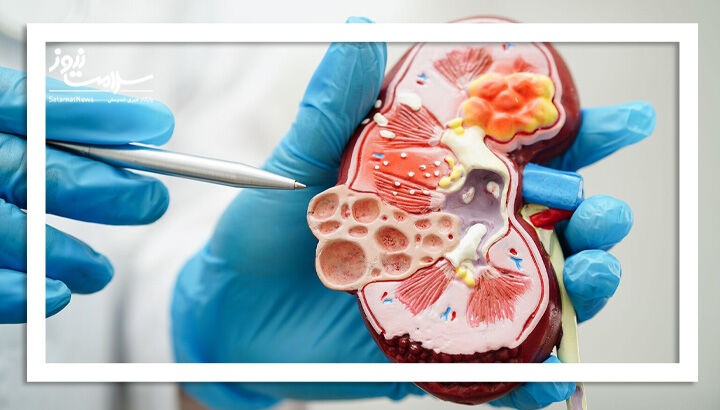 سلامت مغز با عملکرد کلیه‌ها مرتبط است