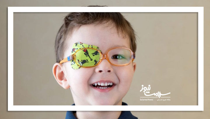 درمانی نوین برای تنبلی چشم: قطع ورودی بینایی برای بازیابی بینایی!