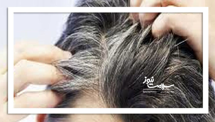 بازگشت رنگ موها پس از سفیدی