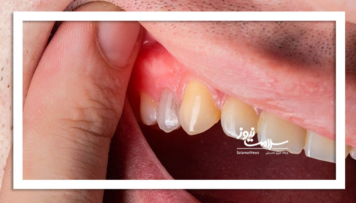 آیا به رشد دوباره دندان در بزرگسالی نزدیک هستیم؟