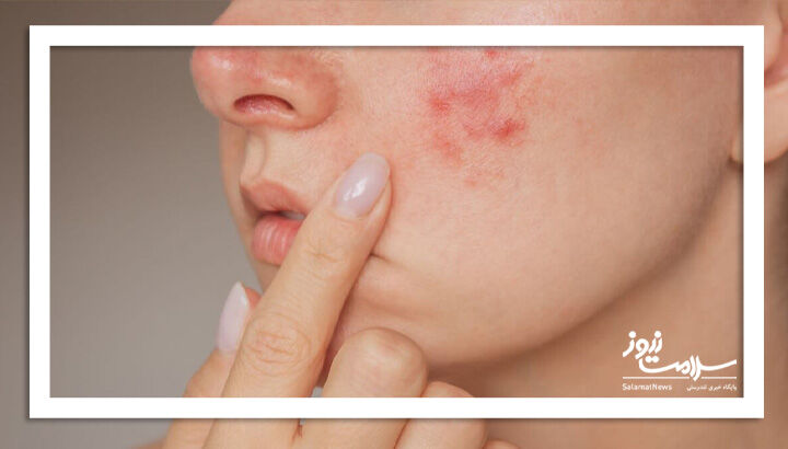 ۳ عارضه نادر اما جدی مکمل‌ ویتامین B12