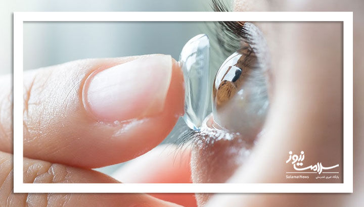 خطر عفونت انگلی چشم برای کاربران لنزهای تماسی