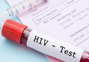 معاون وزیر بهداشت: بر اساس پروتکل وزارت برای شناسایی مبتلایان به HIV اقدام می‌شود
