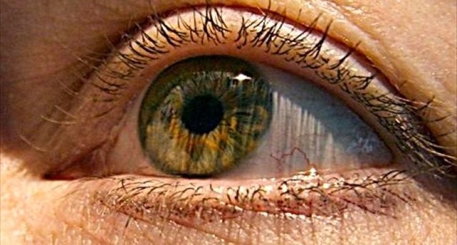 علائم و خطرات "سکته چشمی"