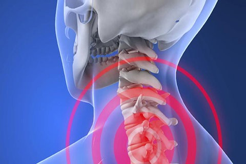 علت دردهای ستون فقرات گردن را بشناسیم