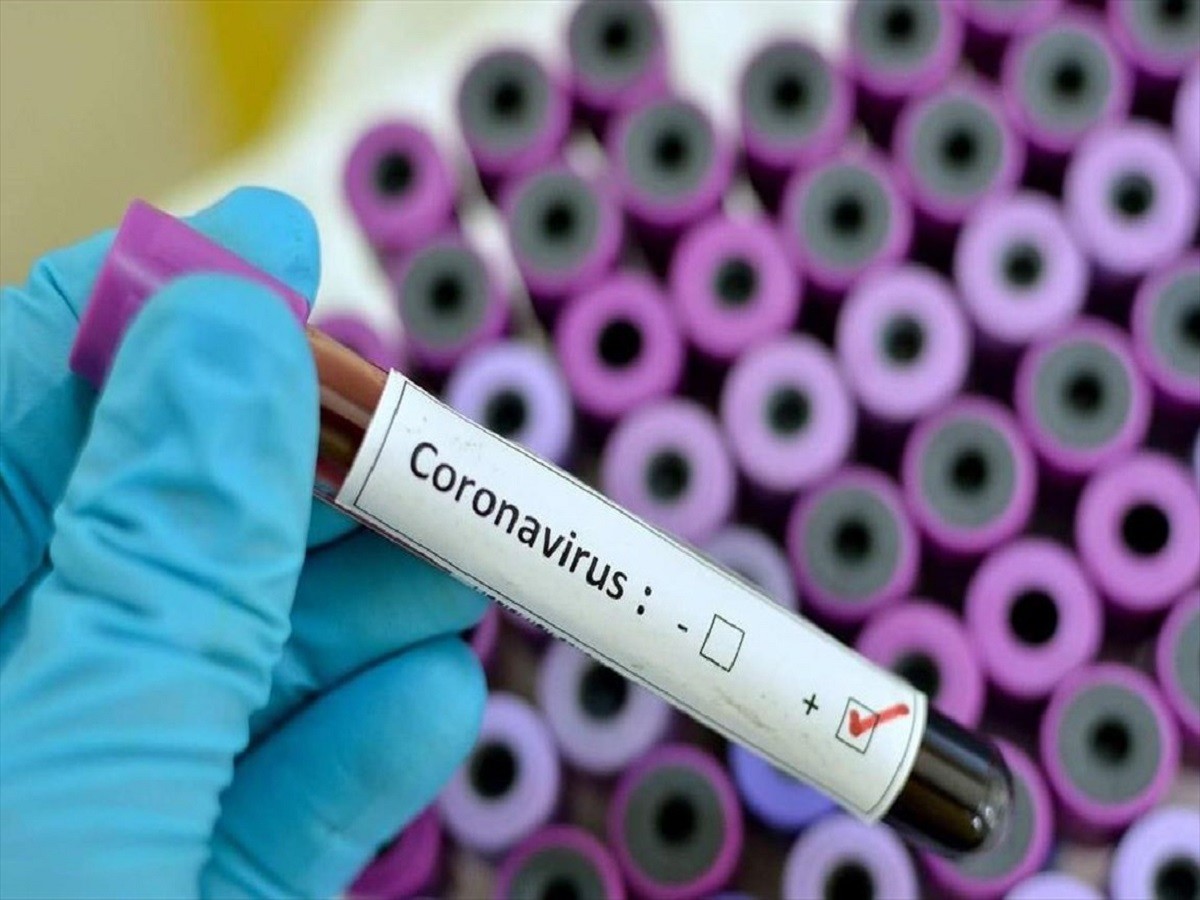 علائم ابتلا به ویروس کرونا چیست؟