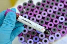 علائم شایع کروناویروس/چگونه بدانیم در معرض خطریم؟