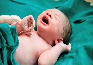 تولد نوزاد از مادر مبتلا به کرونا در اردبیل