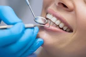 پوسیدگی، شایعترین بیماری دهان و دندان است