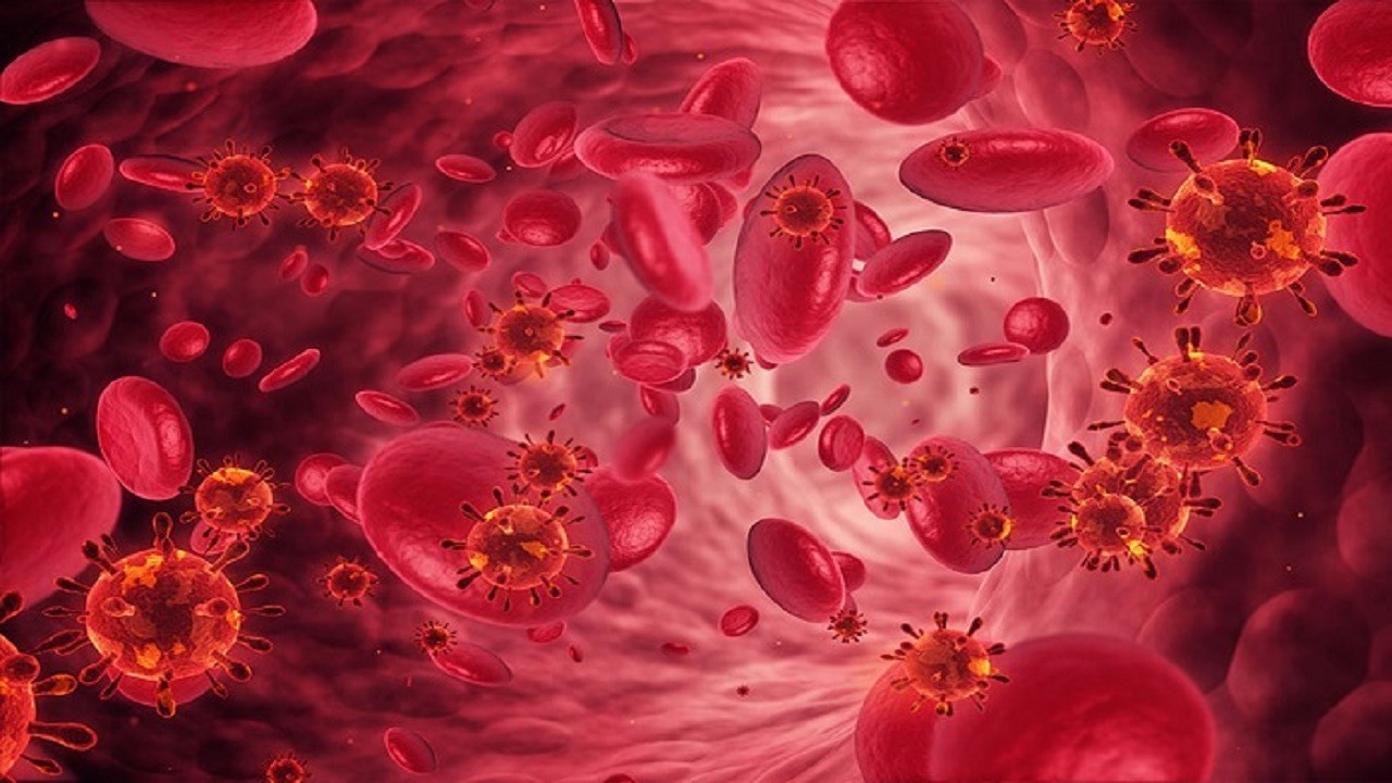 شایع‌ ترین نوع کم‌ خونی کدام است؟