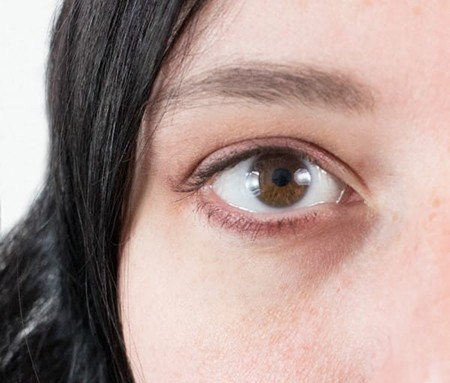 ﻿ طبیعی‌ترین درمان برای سیاهی دور چشم