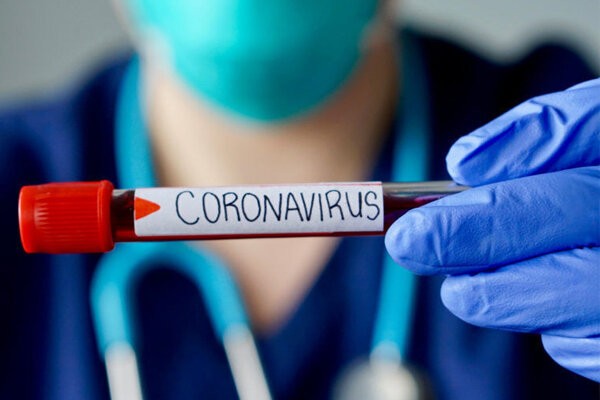 ۲۹ بیمار جدید مبتلا به ویروس کرونا در استان کردستان شناسایی شدند