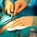 انجام سالانه ۳۰هزار جراحی زیبایی در ایران