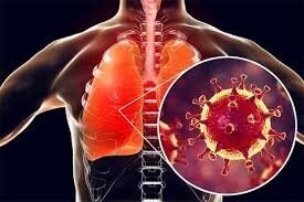 عوارض کروناویروس بر ریه چقدر است؟