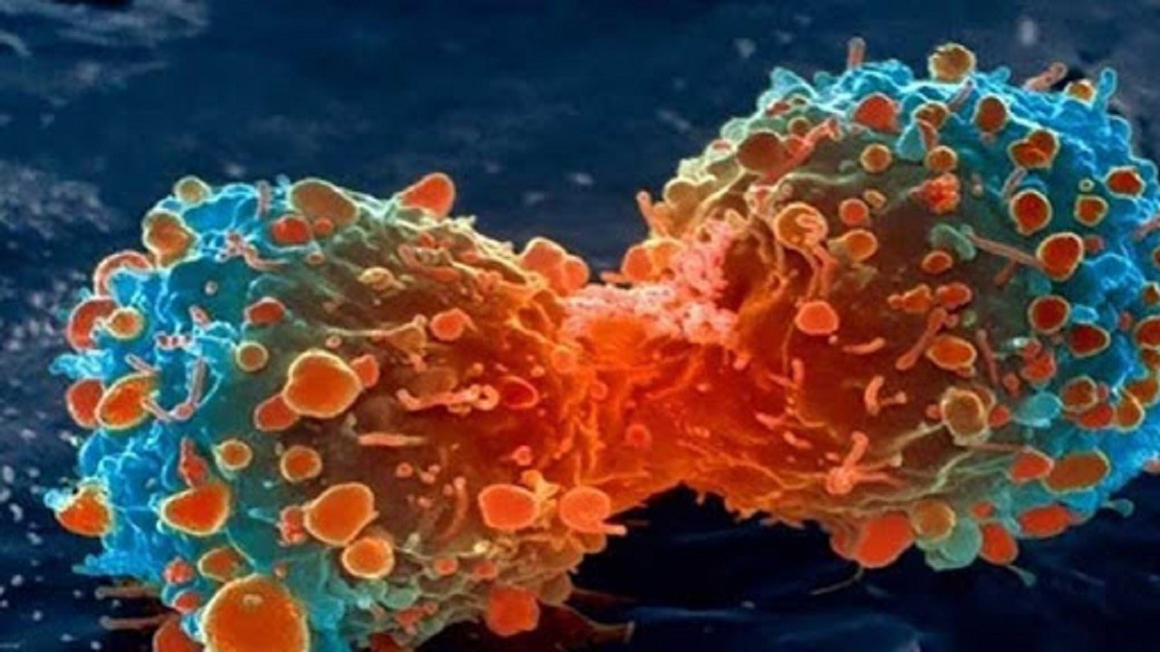 شایعترین سرطان در مردان چیست؟