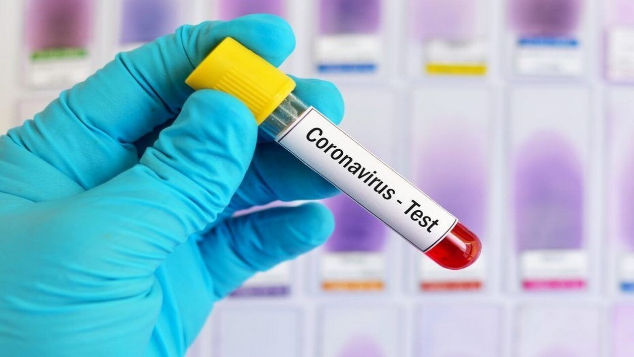 شناسایی ۳۳ مورد جدید مبتلا به کرونا ویروس در ایلام طی شبانه روز گذشته