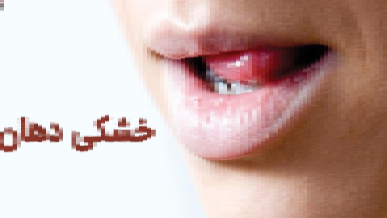 رفع خشکی دهان در ماه رمضان