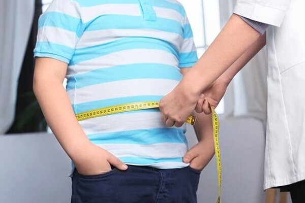 خطر ابتلا به سنگ صفرا با چاقی و اضافه وزن