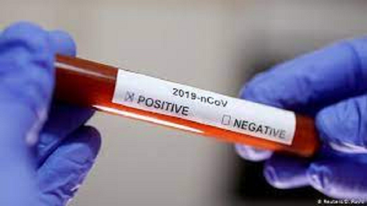 شناسایی ۳۵ مورد جدید مبتلا به کرونا ویروس در ایلام