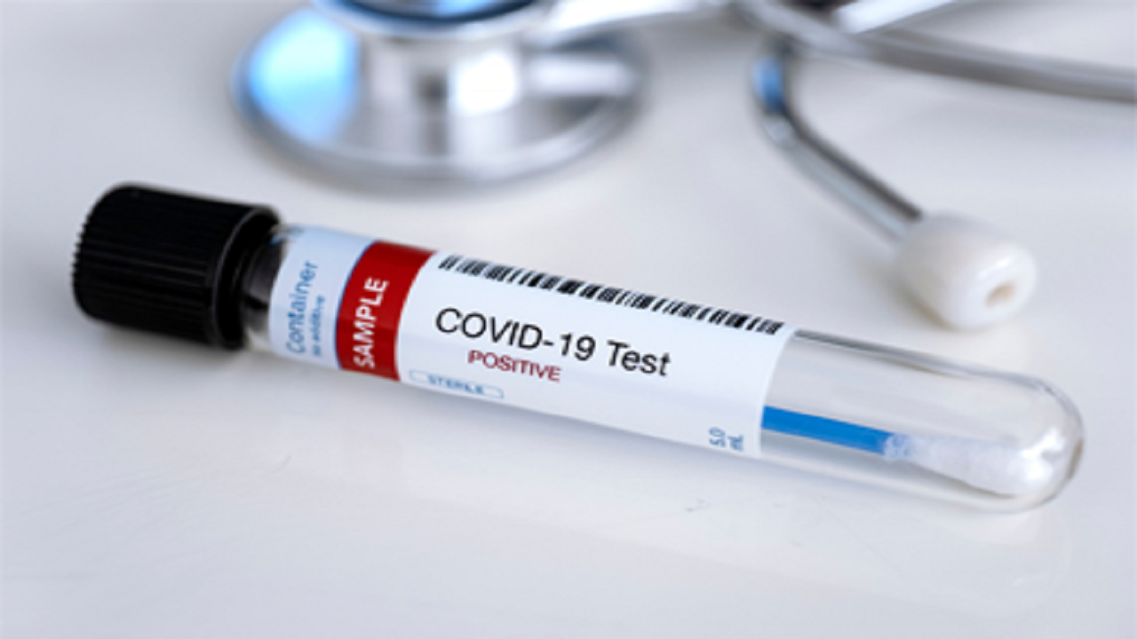 شناسایی ۱۸۷ مورد جدید مبتلا به کرونا ویروس در ایلام / ثبت ۴ مورد فوتی