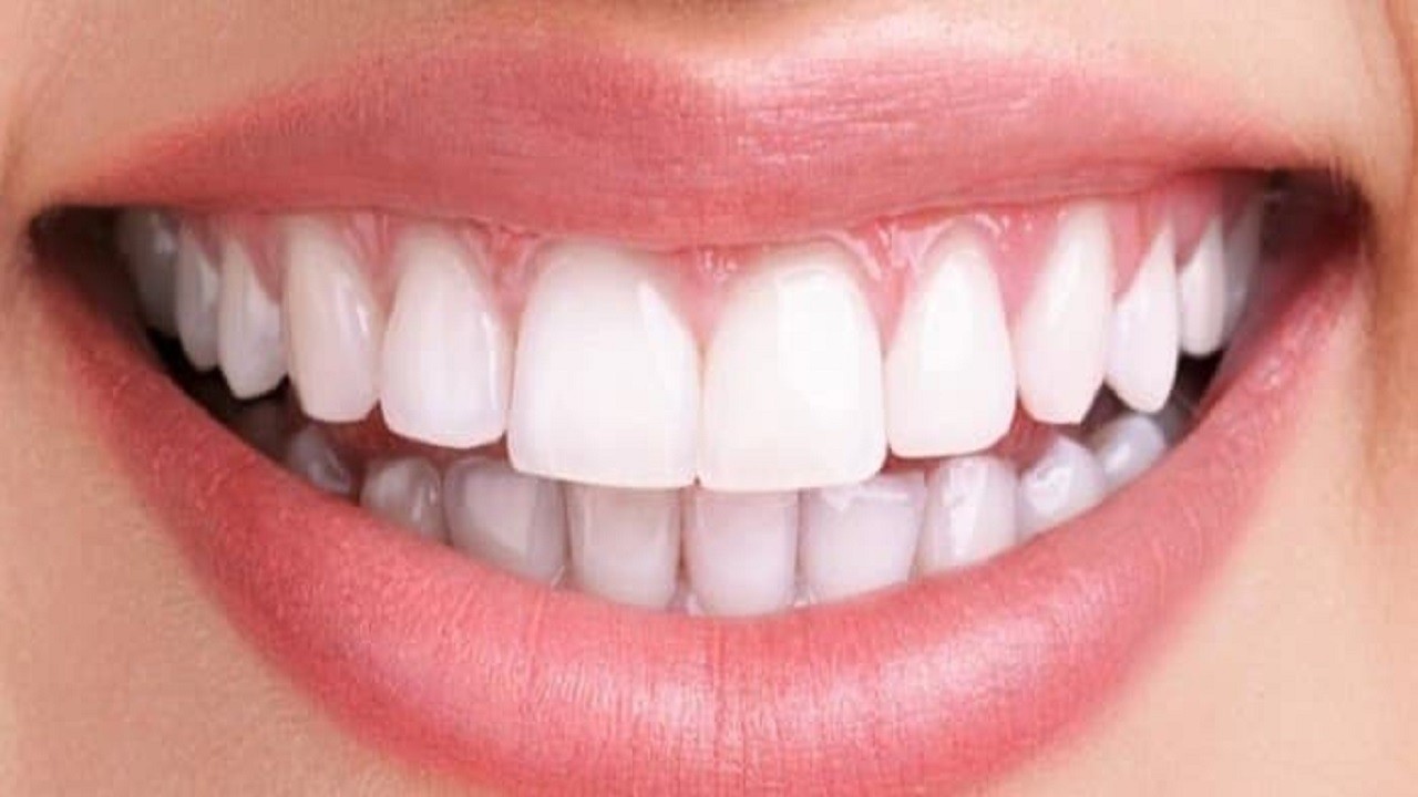 درباره ناهنجارهای دندانی چه می دانید؟