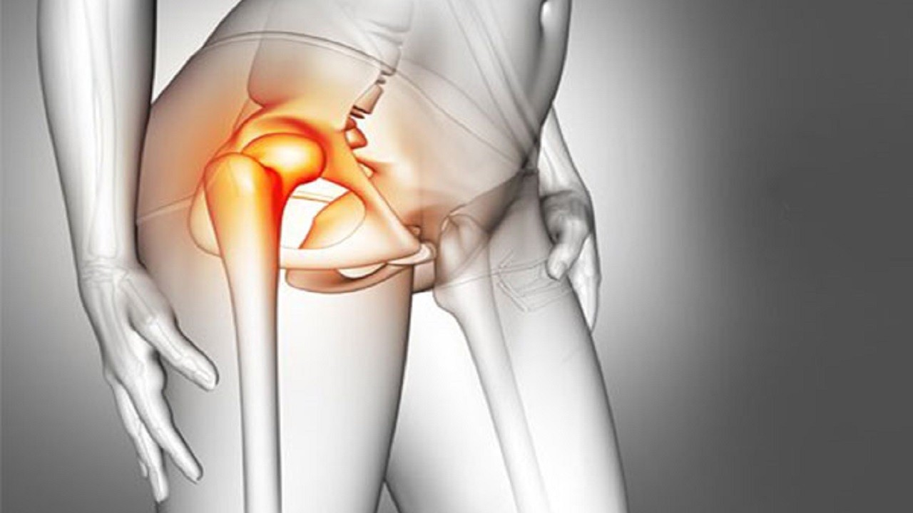درد لگن در ناحیه مفصل ران چه دلایلی دارد؟