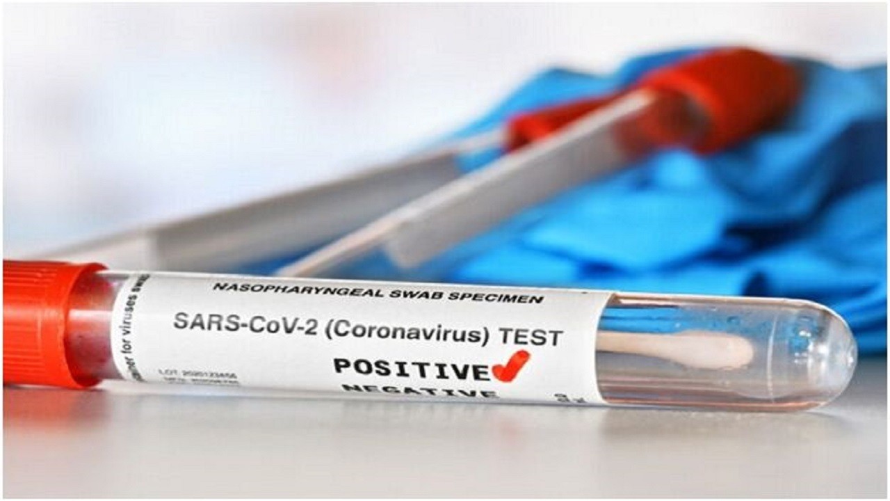 شناسایی ۷۴ مورد جدید مبتلا به کرونا ویروس در ایلام / ثبت ۱ مورد فوتی