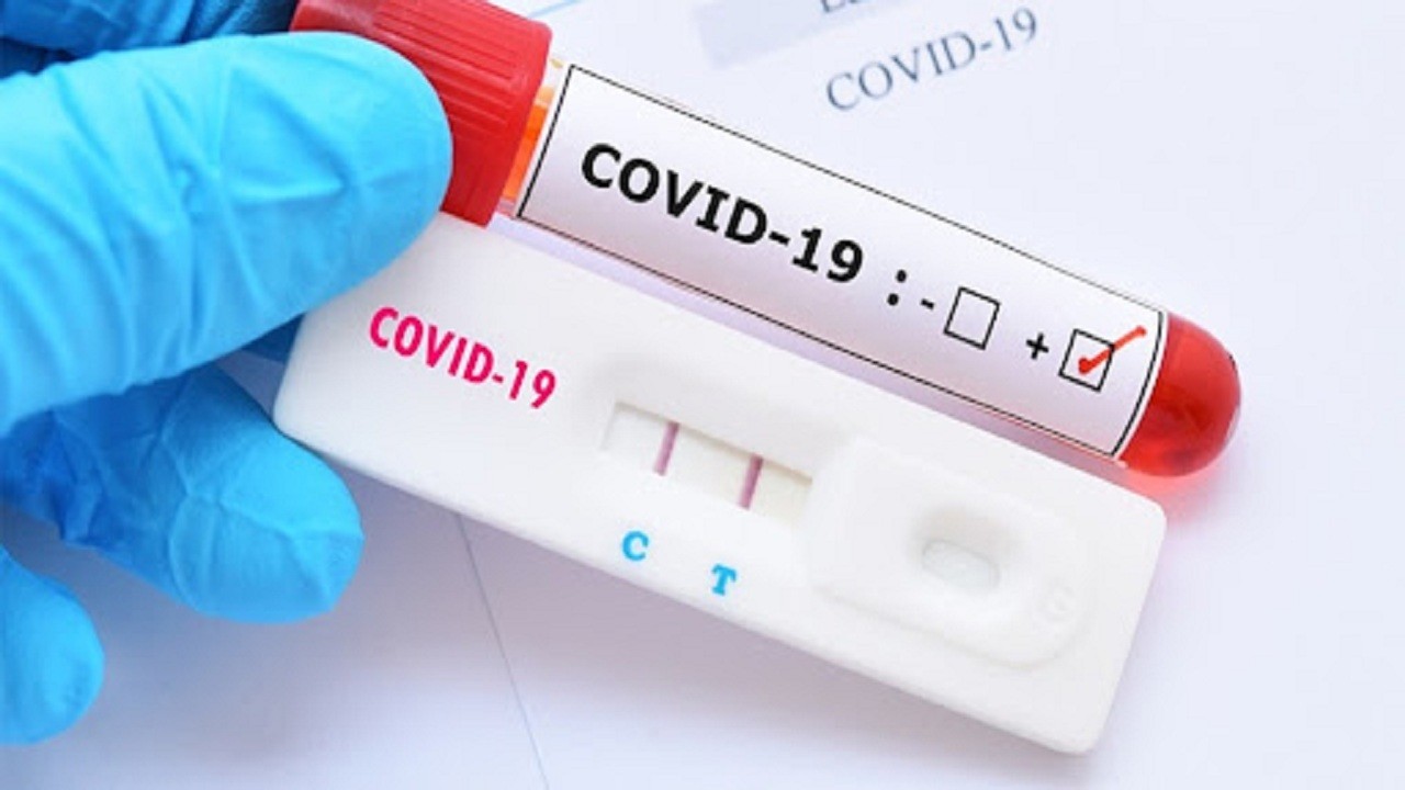 شناسایی ۷۷ مورد جدید مبتلا به کرونا ویروس در ایلام