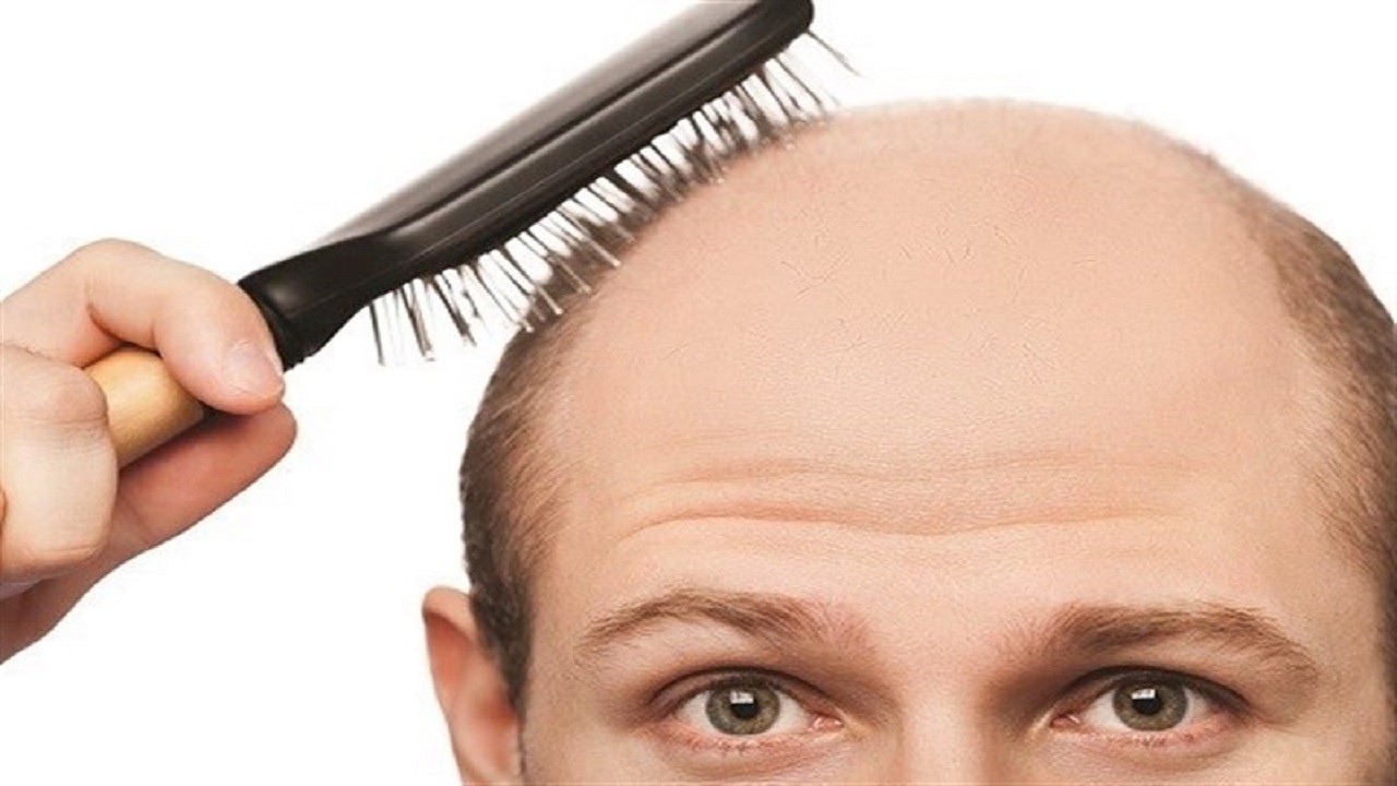 درمان خانگی ریزش مو با ۴ روغن