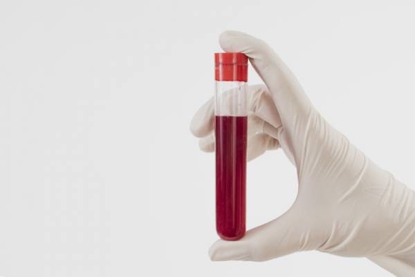هشت نوع سرطان را با این آزمایش خون تشخیص دهید!