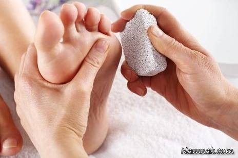 10 راه درمان خانگی برای پوسته شدن پاشنه پا