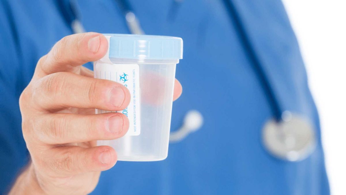 تست اعتیاد از کارگران