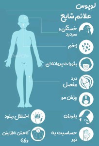 علائم شایع لوپوس