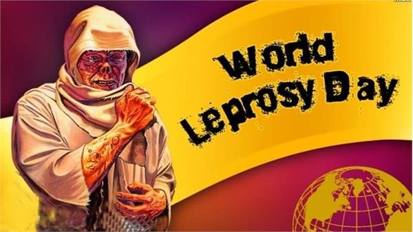 روز جهانی کمک به جذامیان