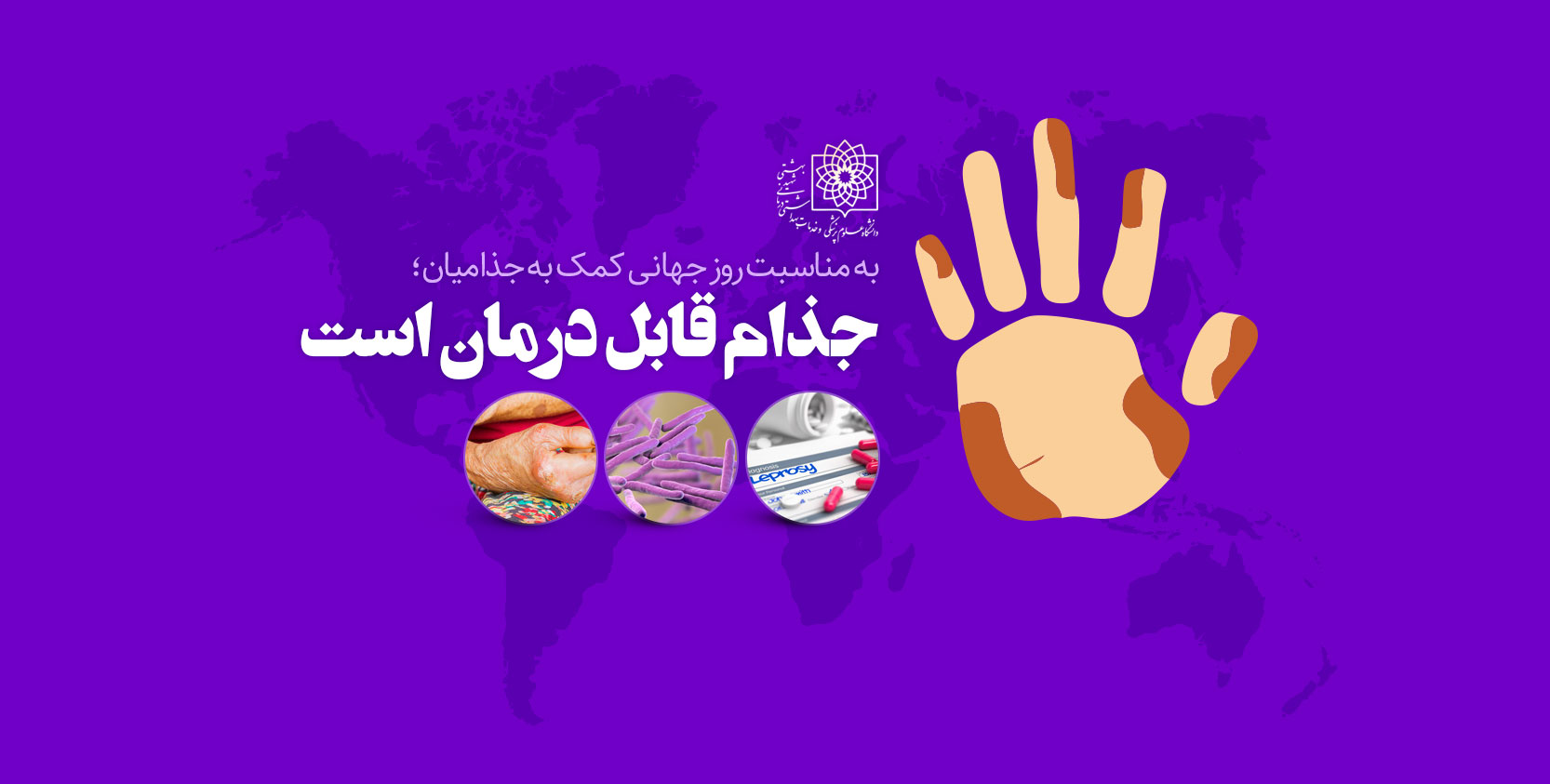 روز جهانی کمک به جذامیان