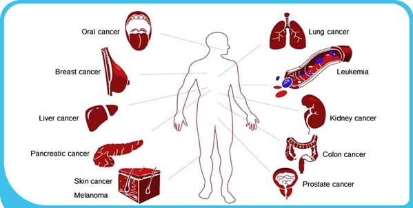 روز جهانی سرطان