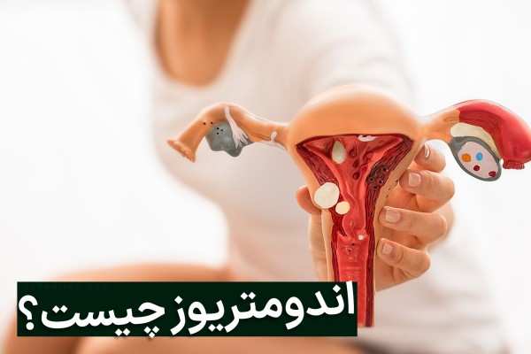 زن نشسته با لباس سفید ماکت دستگاه تناسلی زنانه را در دست دارد