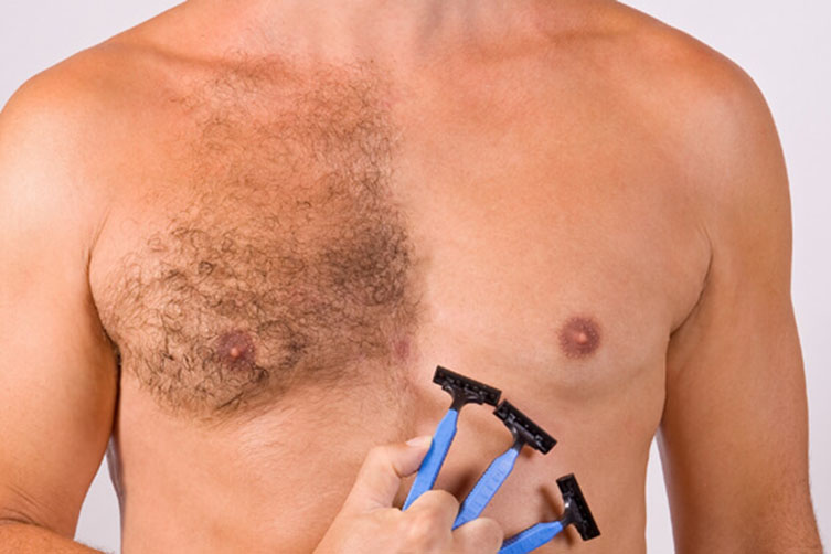 موهای زائد مردان