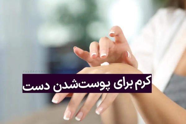 کرم برای پوست شدن کف دست